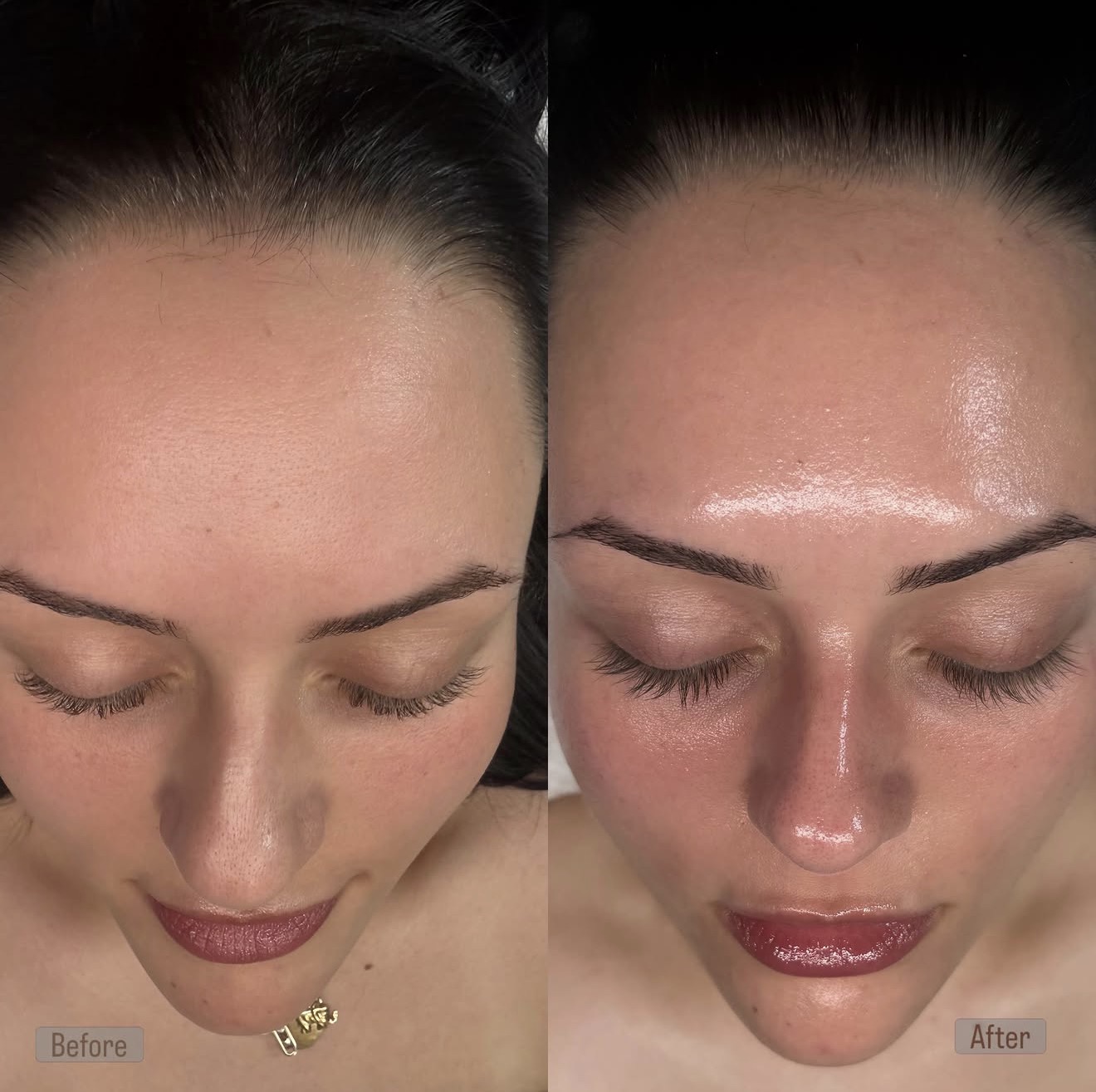 Before and after skin glow and hydration