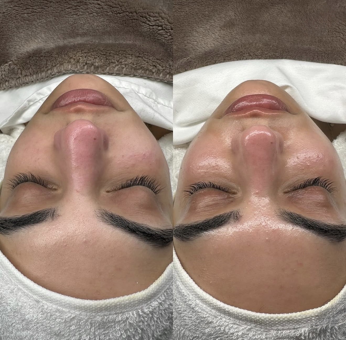 Before and after pore refinement